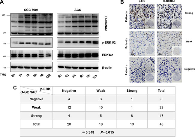Correlation of p-ERK 1/2 with O-GlcNAcylation in vitro and in vivo
