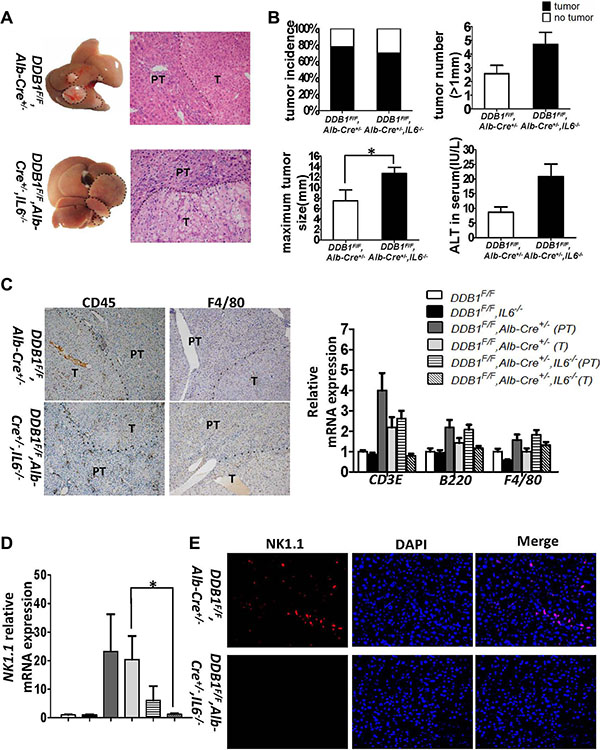 IL6 suppressed inflammation-associated HCC development by modulating NK cells.