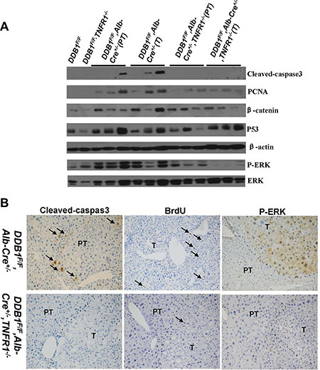 Reduction of cell apoptosis and compensatory proliferation, P-ERK level in DDB1F/F,Alb-Cre+/&#x2212;,TNFR1&#x2212;/&#x2212; mouse.