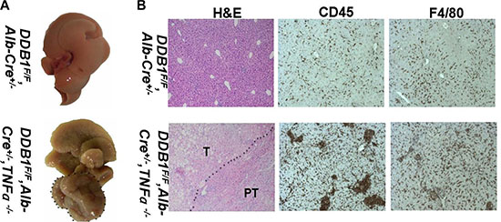 Deletion of TNF&#x03B1; accelerated tumor development in DDB1F/F,Alb-Cre+/&#x2212; mouse.