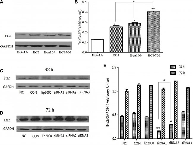 Expression of Ets2 protein was notably increased in ESCC cells and knocked down by siRNA.