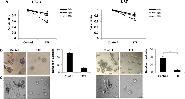 Effect of TTF on the cell proliferation and phenotypic transition of GBM cells.
