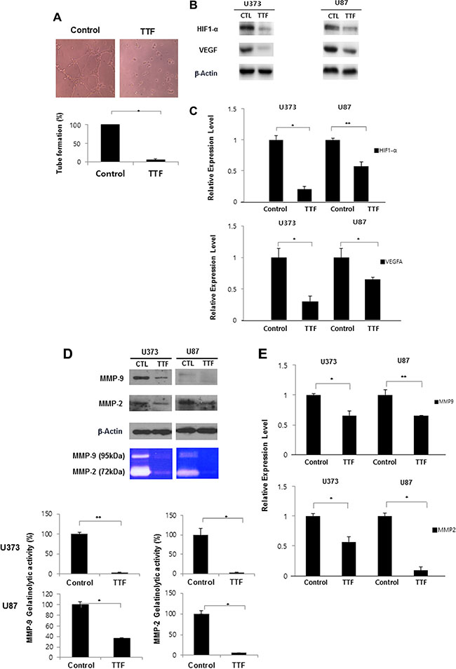 TTF inhibits angiogenesis of endothelial cells through inhibition of MMP-2 and MMP-9.