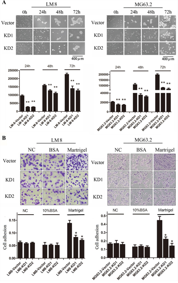 Effects of CD151 knockdown on osteosarcoma cell-cell attachment and cell adhesion.