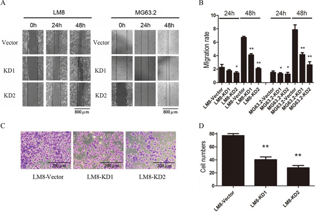 CD151 knockdown inhibits osteosarcoma cell migration and invasion.