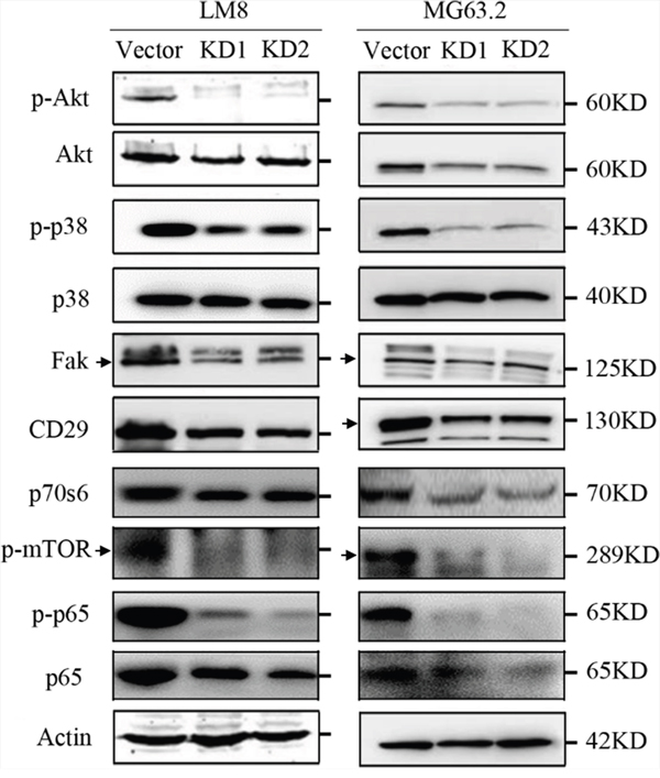 CD151 silencing alters osteosarcoma cell signaling.