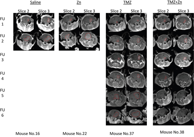 Tumor detection by contrast enhanced T1-weighted MRI of xenograft mice.