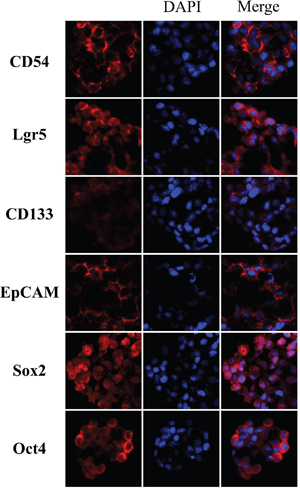 Immunofluorescence of gastric cancer stem cells spheres.