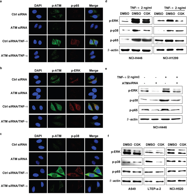 ATM mediate TNF-&#x03B1; inducing ERK/p38-NF-&#x03BA;B activation in lung cancer cells.