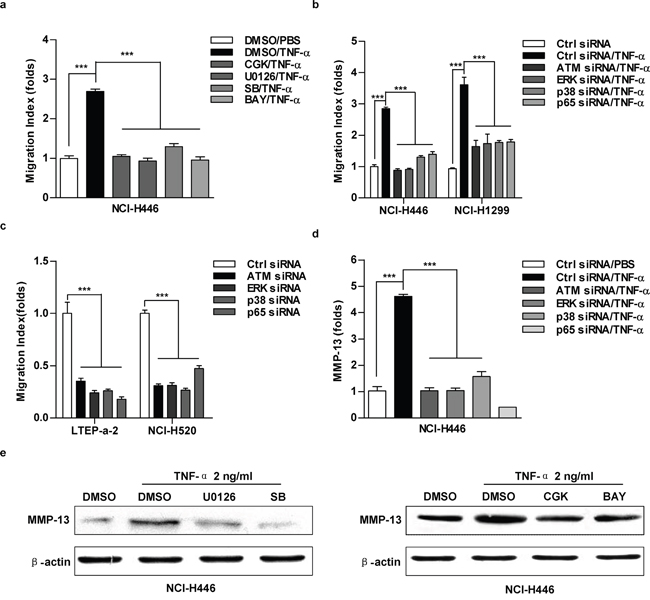 The inhibition of ATM-ERK/p38-NF-&#x03BA;B abrogate TNF-&#x03B1; increasing MMP-13 expression and cell migration in lung cancer cells.