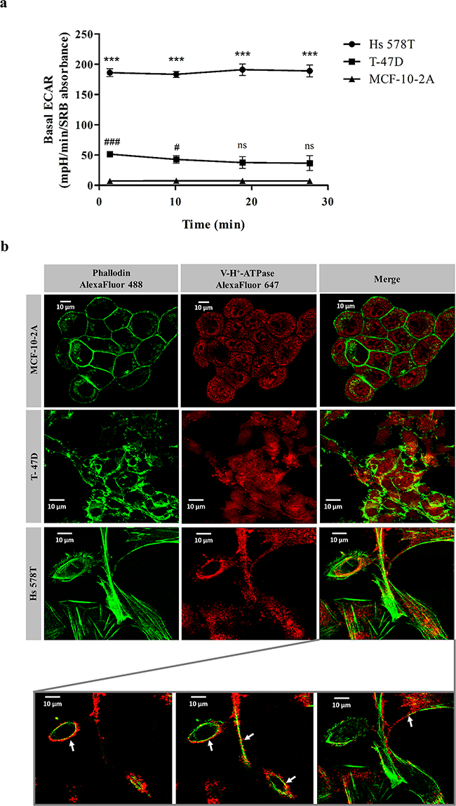 Basal extracellular acidification rate and cellular distribution of V-H+-ATPase on breast cells.