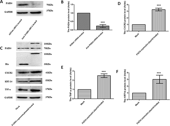 Determination of the protein expression levels of PADI4, CXCR2, KRT-14 and TNF-&alpha; in MNK-45 cells either treated with anti-PADI4 siRNA or transfected with a PADI4-overexpressing plasmid using western blot analysis.