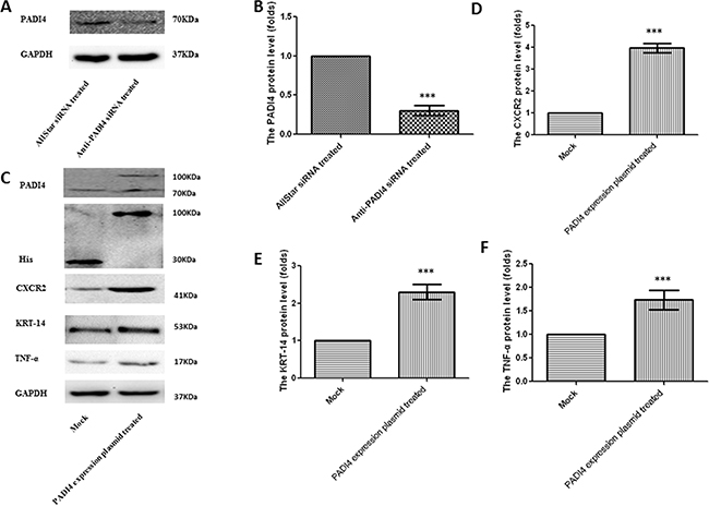 Determination of protein expression levels of PADI4, CXCR2, KRT-14 and TNF-&alpha; in SGC 7901 cells either treated with anti-PADI4 siRNA or transfected with a PADI4-overexpressing plasmid using western blot analysis.