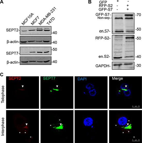 The expression and localization of SEPT2 and SEPT7 in BC cells.