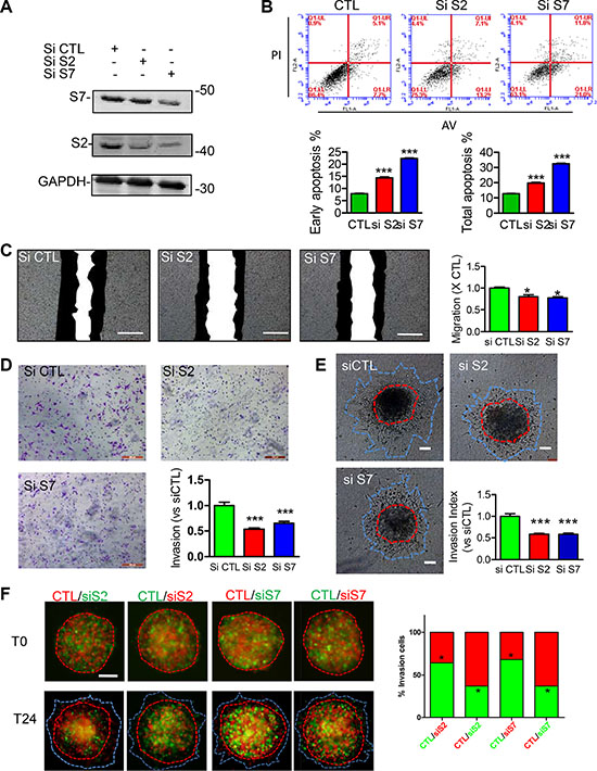 Effects of acute knockdown for SEPT2 and SEPT7 on BC cell apoptosis, migration and invasion.