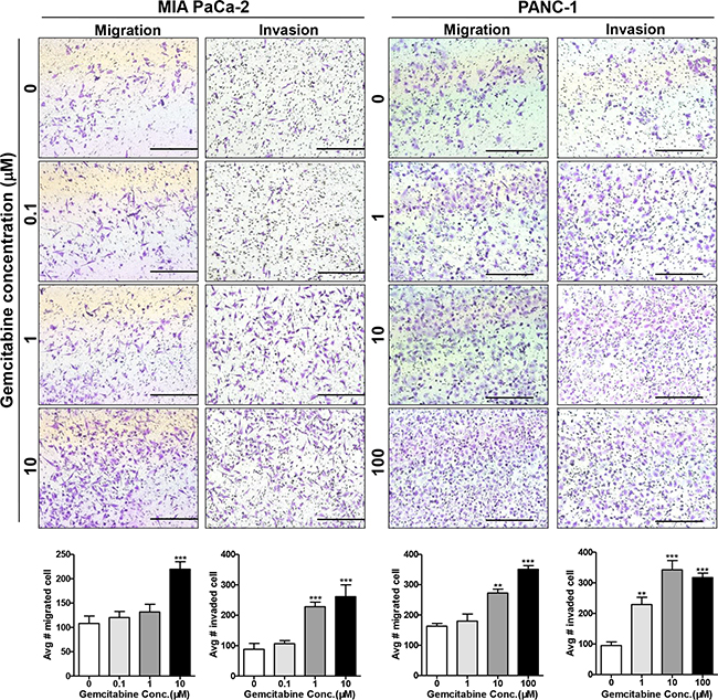 Gemcitabine enhances the migration and invasion of pancreatic cancer cells.