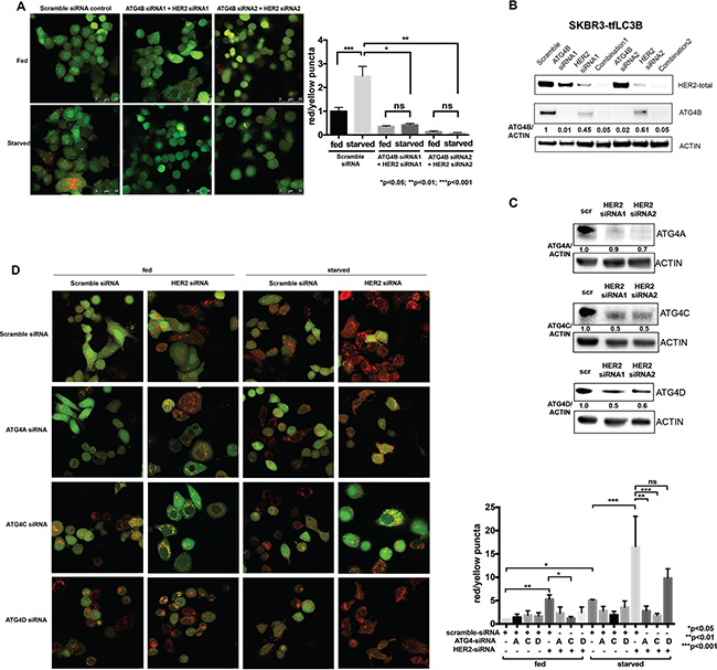 ATG4B, as well as ATG4C and ATG4A, contribute to the increased autophagic flux following HER2 knockdown.