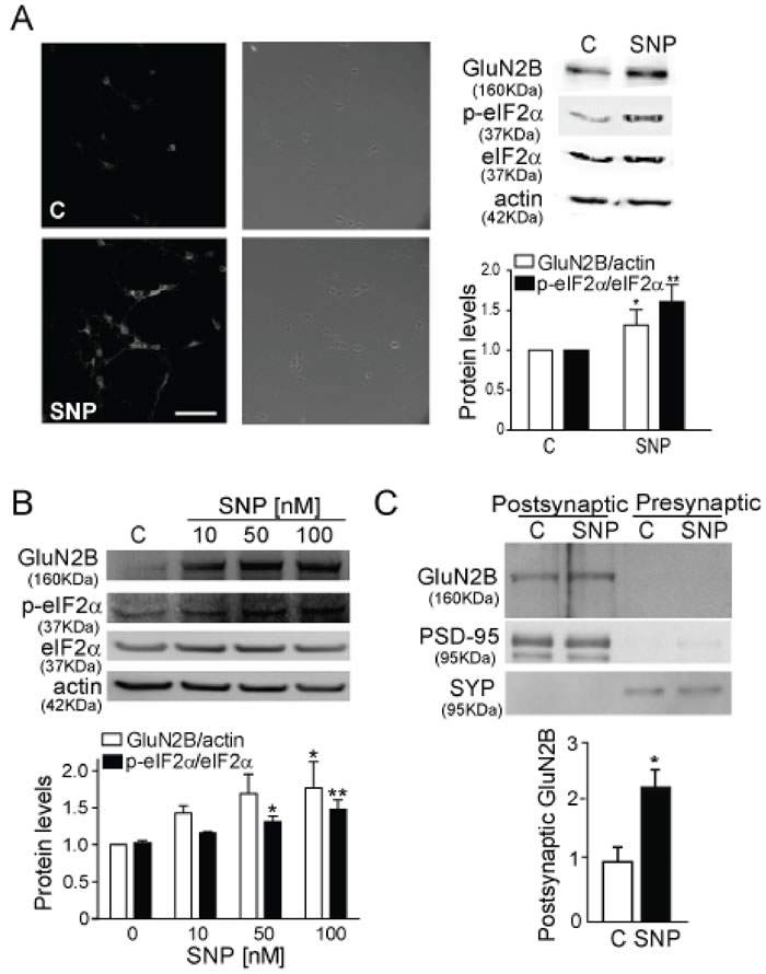NO induces GluN2B expression and eIF2&#x3b1; phosphorylation.