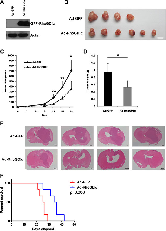 RhoGDI&#x03B1; reduced GSCs tumorigenic potential.