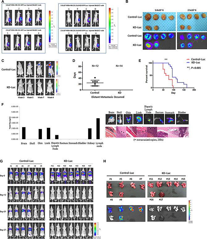 Knockdown of ELK3 expression in MDA-MB-231 cells results in loss of metastatic ability in vivo.