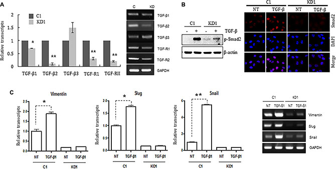 Knocking down ELK3 in MDA-MB-231 cells renders them unresponsive to TGF-&#x00DF;.