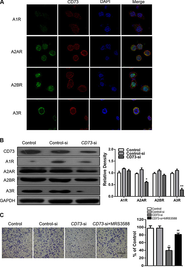 CD73 promotes invasion and metastasis of HNSCC through adenosine A3 receptor stimulation.