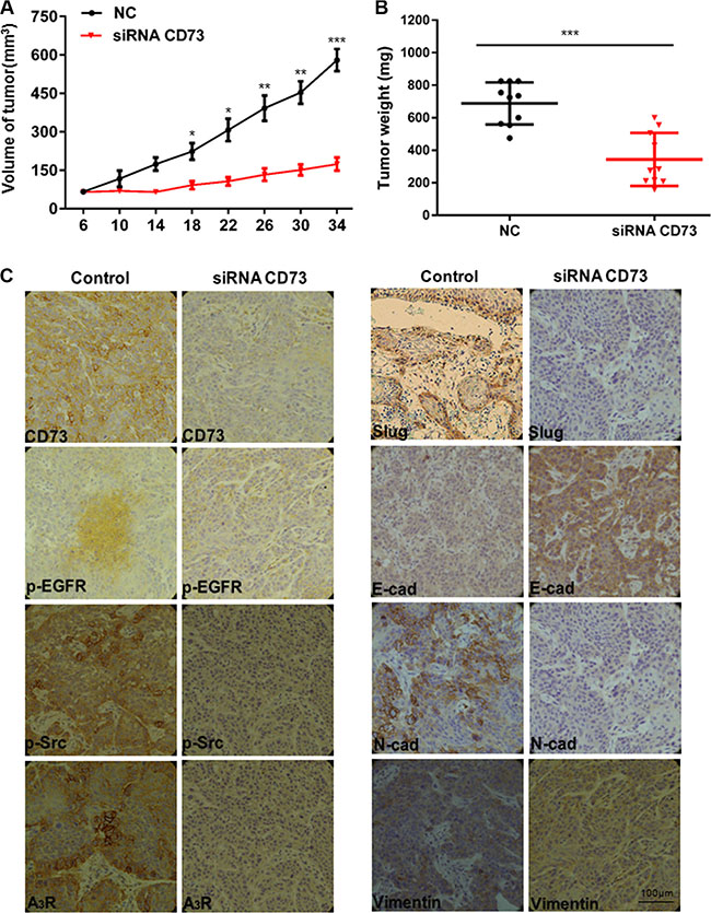 si-CD73 inhibits HNSCC tumor growth and suppress EMT in vivo.