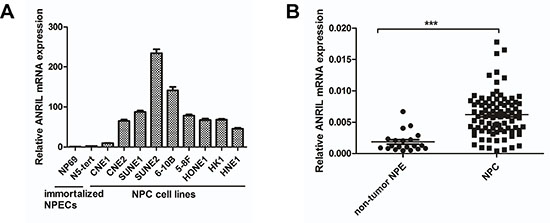 ANRIL expression is frequently upregulated in NPC cell lines and tissues.