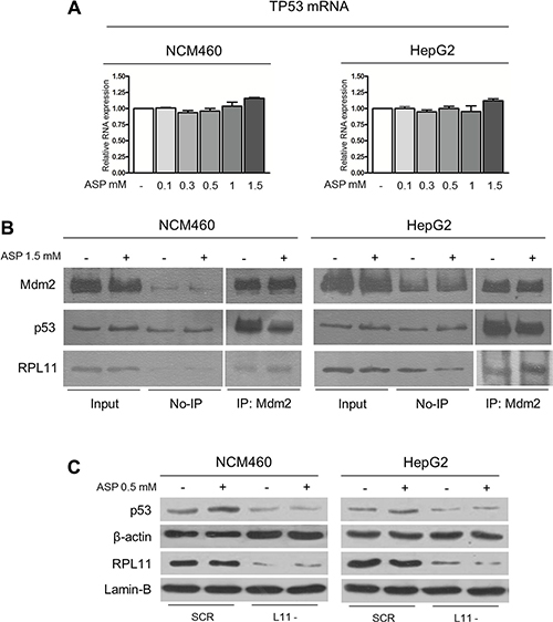Aspirin increases p53 protein expression through the RP/Mdm2/p53 pathway.