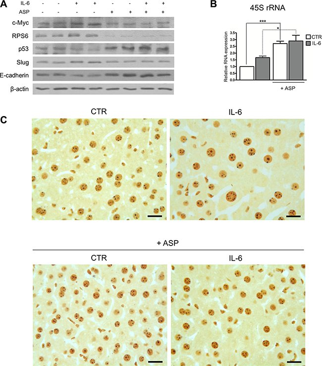 Aspirin counteracts the pro-tumorigenic effects of IL-6 in mouse hepatocytes in vivo.