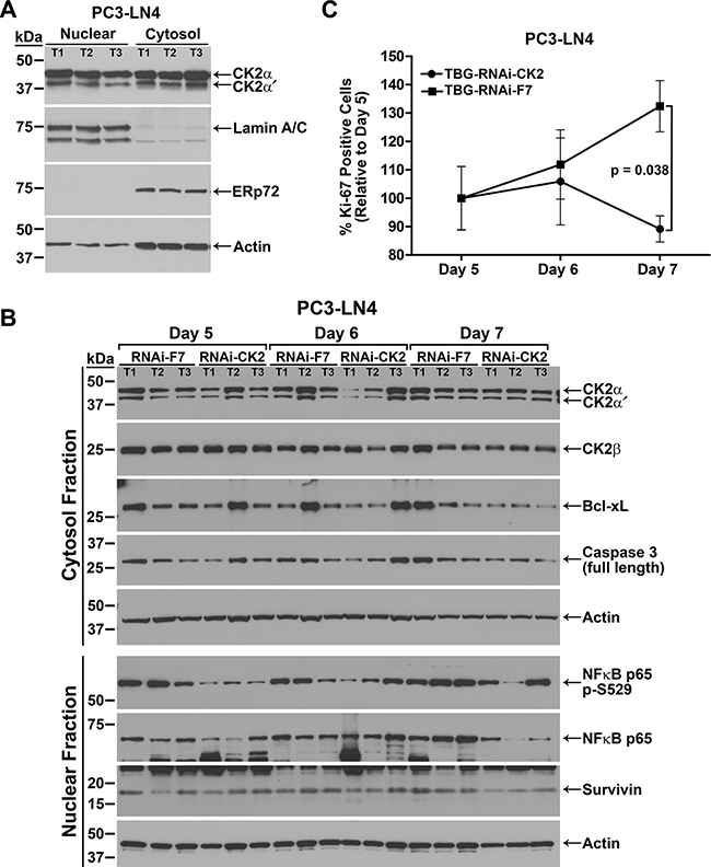 Response over time to TBG-RNAi-CK2 treatment in PC3-LN4 xenograft tumors.