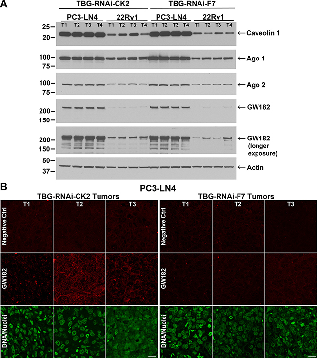 Cellular expression of TBG nanocapsule uptake and RNAi-CK2 oligomer processing markers in xenograft tumors.