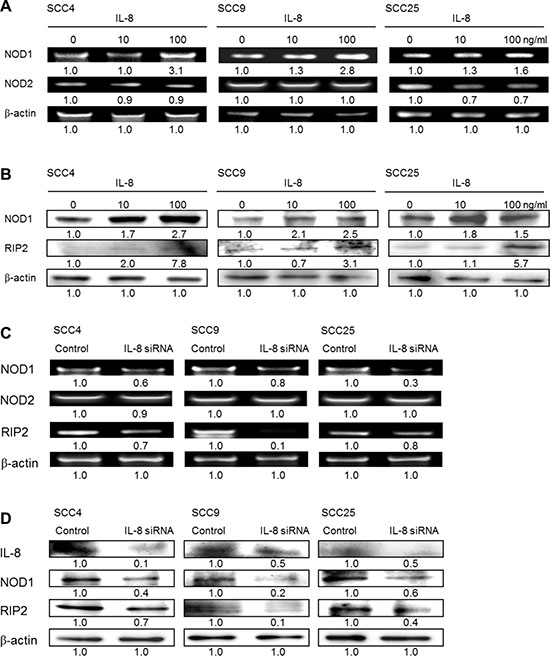 NOD1 signaling, but not NOD2, is involved in IL-8-mediated HNSCC cell proliferation.