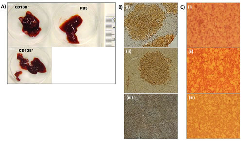 CD138- cells colonized and produced tumors in the liver and bone marrow of mice: