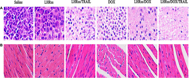 The histological characteristic of MCF-7/ADR tumor tissue and organ histology.