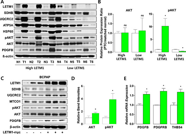 Correlation of LETM1 expression with oxidative phosphorylation (OxPhos) and cellular proliferation signaling.