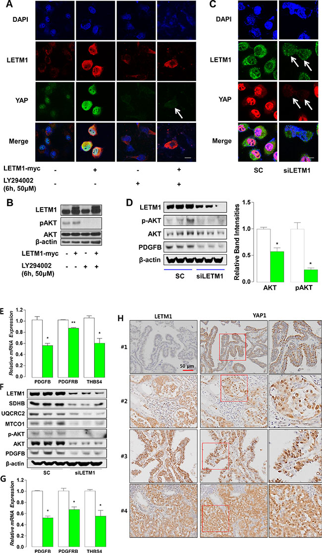 Subcellular localization of YAP1 is modified by LETM1 over-expression or silencing.