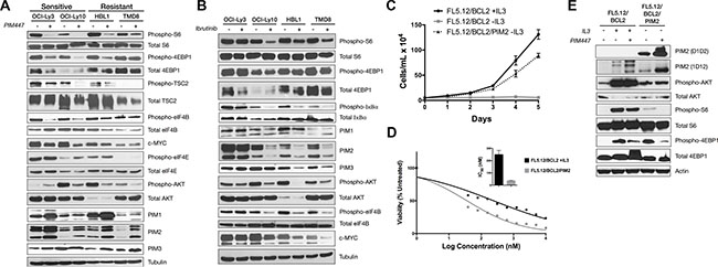 Loss of mTORC1 activation in PIM447-sensitive ABC-DLBCL lines and independent PIM2-driven system.