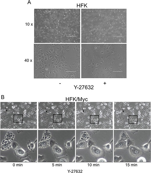 Y-27632 rapidly reduces membrane blebbing in Myc-expressing keratinocytes.