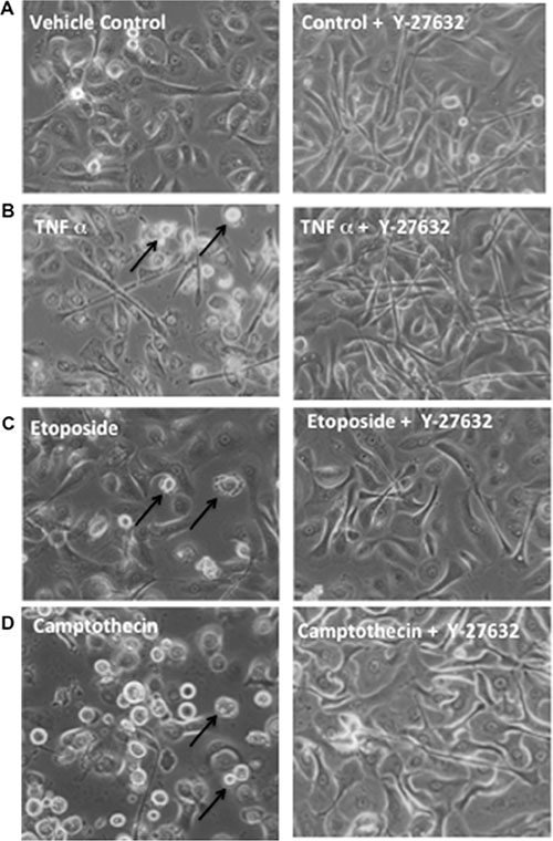Y-27632 suppresses apoptotic rounding and detachment in response to inducers of extrinsic death receptor or intrinsic mitochondrial apoptosis.