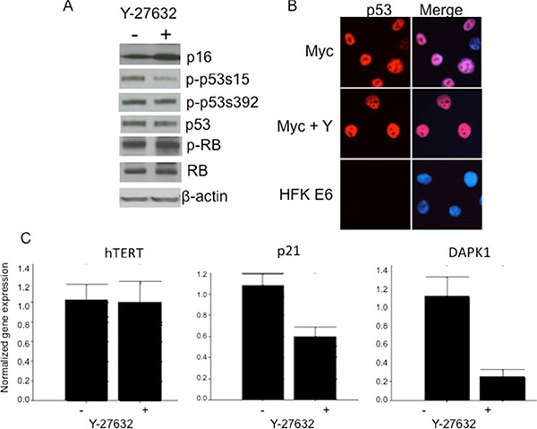 Y-27632 alters phosphorylation of p53 and expression of p53 target genes.