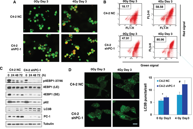 Suppression of PC-1/PrLZ induced autophagy in C4-2 cells after IR treatment.