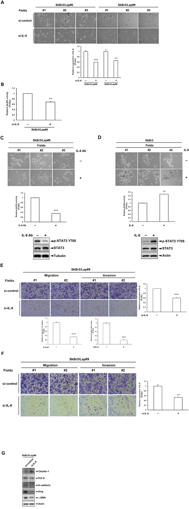 IL-6 is required for the maintenance of stemness property in cells with acquired lapatinib-resistance.