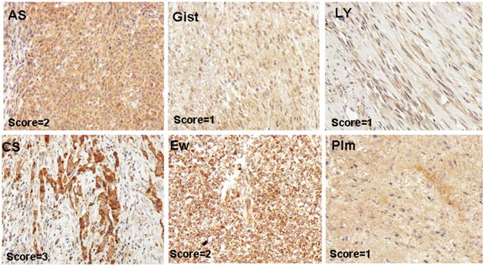 Representative pictures of MAP17-stained sarcoma samples.