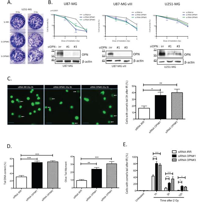 OPN inhibition affects the survival of GBM cells and delays DNA double-strand break repair.