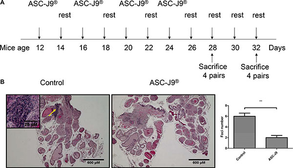 ASC-J9&#x00AE; reduces prostatitis in the NOD mouse.