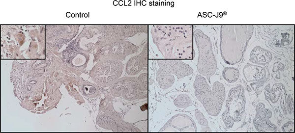 Immunohistochemical staining for CCL2.