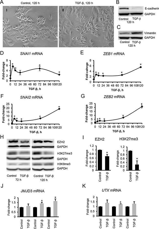 TGF-&#x03B2; induces EMT and changes in EZH2 and H3K27me3 in ovarian cancer cells.