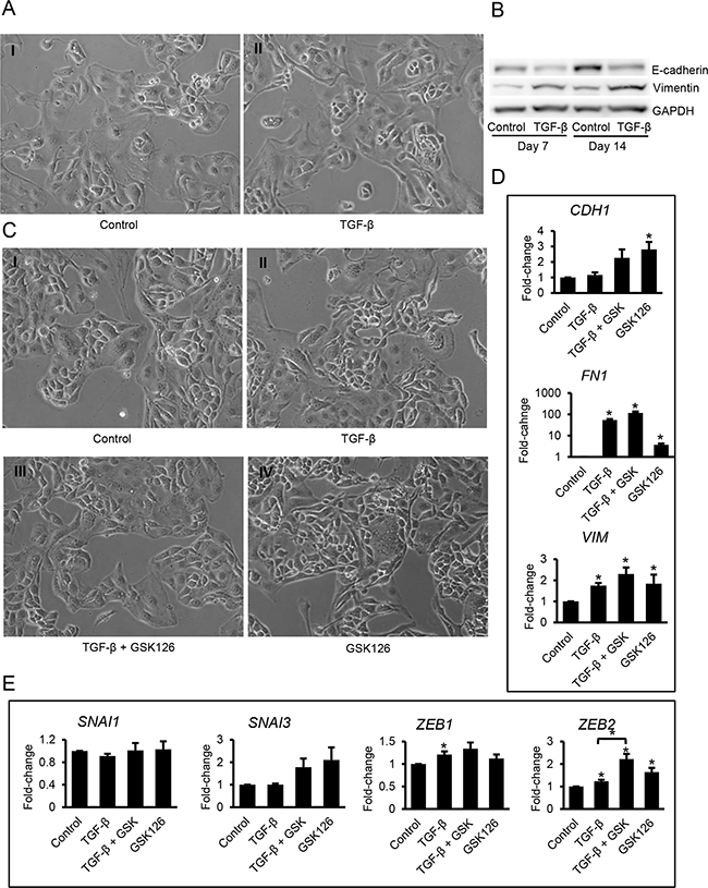 Effects of TGF-&#x03B2; and GSK126 on Kuramochi ovarian cancer cells.