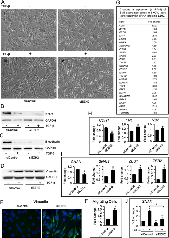 Effects of EZH2 knock down by siRNA in ovarian cancer cells.